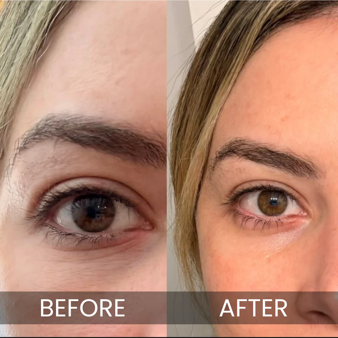 Luxe - Korean Under-Eye Balm - Image 10
