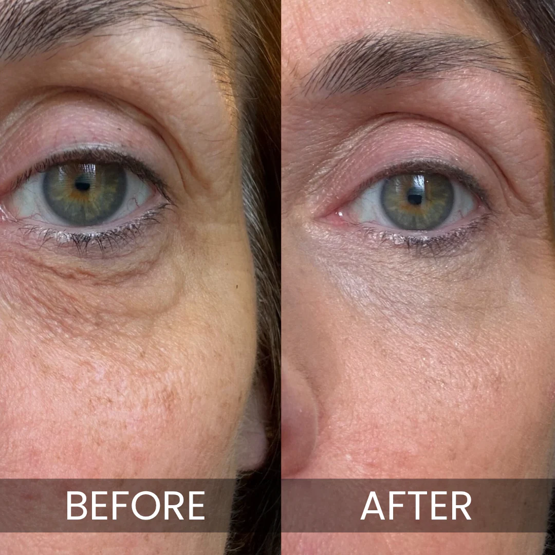 Luxe - Korean Under-Eye Balm - Image 4